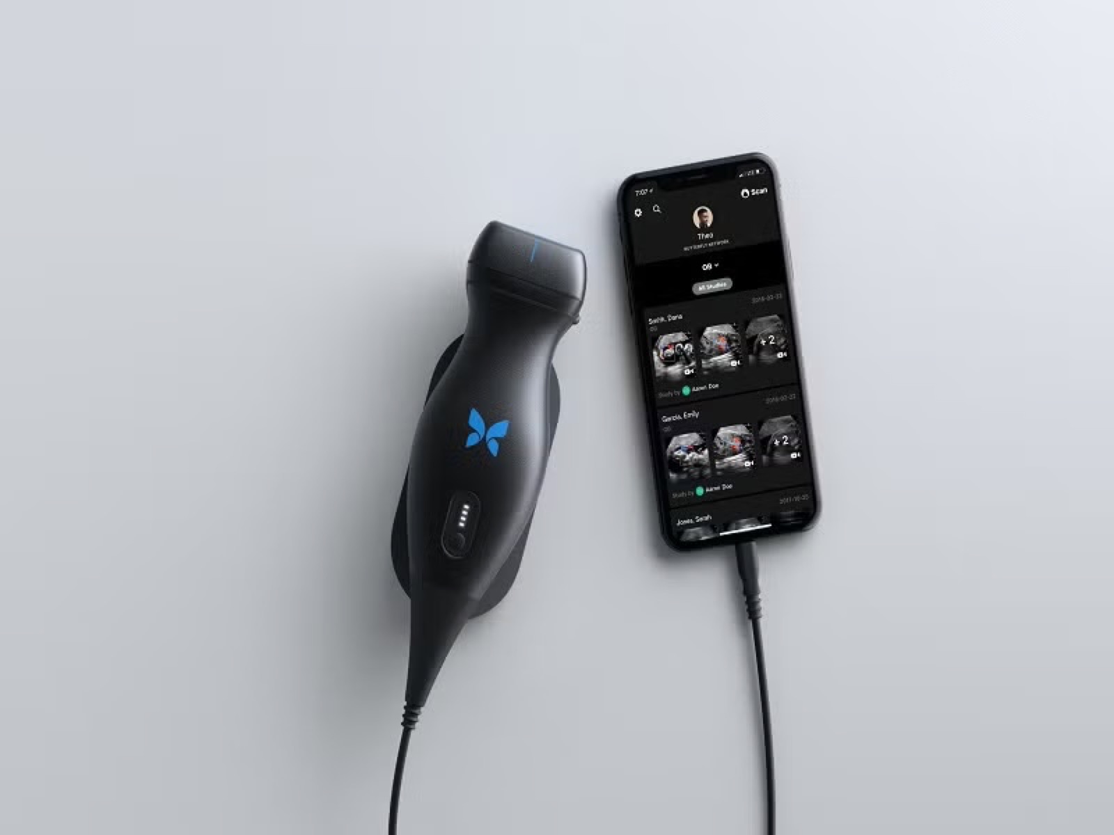 Butterfly iQ handheld ultrasound